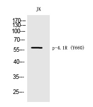 Rabbit Polyclonal Antibody to 4.1R (Phospho-Tyr660)