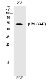 Rabbit Polyclonal Antibody to Brk (Phospho-Tyr447)
