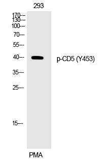 Rabbit Polyclonal Antibody to CD5 (Phospho-Tyr453)