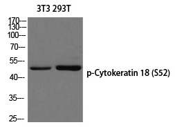 Rabbit Polyclonal Antibody to Cytokeratin 18 (Phospho-Ser52)