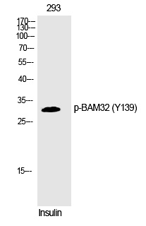 Rabbit Polyclonal Antibody to BAM32 (Phospho-Tyr139)