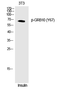 Rabbit Polyclonal Antibody to GRB1(Phospho-Tyr67)