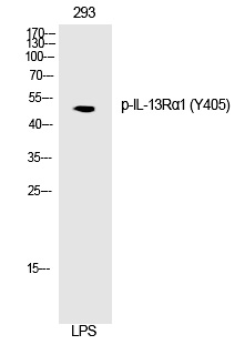 Rabbit Polyclonal Antibody to IL-13Rα1 (Phospho-Tyr405)
