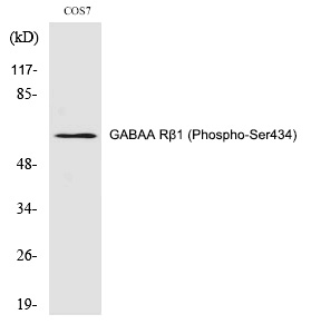 Rabbit Polyclonal Antibody to GABAA Rβ1 (Phospho-Ser434)