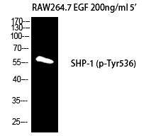 Rabbit Polyclonal Antibody to SH-PTP1 (Phospho-Tyr536)