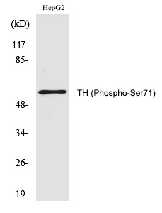 Rabbit Polyclonal Antibody to TH (Phospho-Ser71)