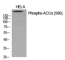 Rabbit Polyclonal Antibody to ACCα (Phospho-Ser80)