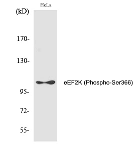 Rabbit Polyclonal Antibody to eEF2K (Phospho-Ser366)