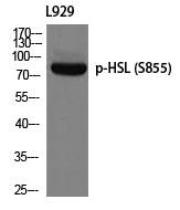 Rabbit Polyclonal Antibody to HSL (Phospho-Ser855)
