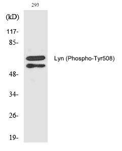 Rabbit Polyclonal Antibody to Lyn (Phospho-Tyr508)