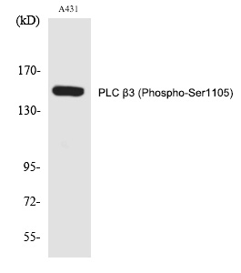 Rabbit Polyclonal Antibody to PLC β3 (Phospho-Ser1105)