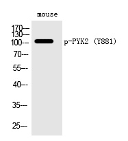 Rabbit Polyclonal Antibody to PYK2 (Phospho-Tyr881)