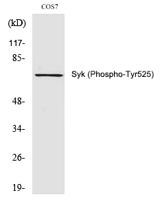 Rabbit Polyclonal Antibody to Syk (Phospho-Tyr525)