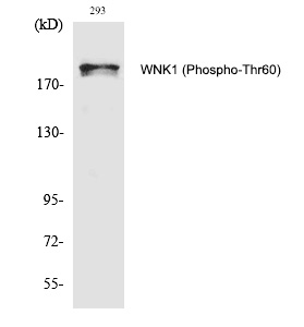 Rabbit Polyclonal Antibody to WNK1 (Phospho-Thr60)