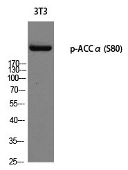 Rabbit Polyclonal Antibody to ACCα (Phospho-Ser80)