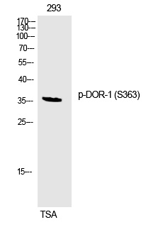 Rabbit Polyclonal Antibody to DOR-1 (Phospho-Ser363)