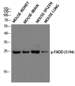 Rabbit Polyclonal Antibody to FADD (Phospho-Ser194)