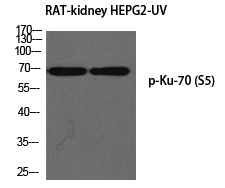Rabbit Polyclonal Antibody to Ku-7(Phospho-Ser5)