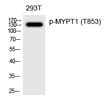 Rabbit Polyclonal Antibody to MYPT1 (Phospho-Thr853)