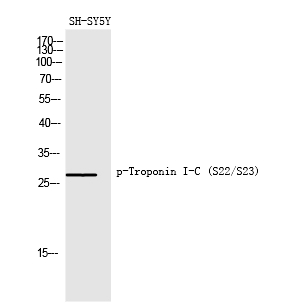 Rabbit Polyclonal Antibody to Troponin I-C (Phospho-Ser22/Ser23)