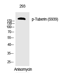 Rabbit Polyclonal Antibody to Tuberin (Phospho-Ser939)