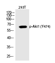 Rabbit Polyclonal Antibody to Akt1 (Phospho-Tyr474)