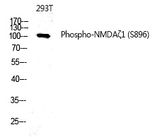 Rabbit Polyclonal Antibody to NMDAζ1 (Phospho-Ser896)