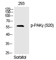 Rabbit Polyclonal Antibody to PAKγ (Phospho-Ser20)
