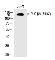 Rabbit Polyclonal Antibody to PLC β3 (Phospho-Ser537)