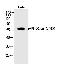 Rabbit Polyclonal Antibody to PFK-2 car (Phospho-Ser483)