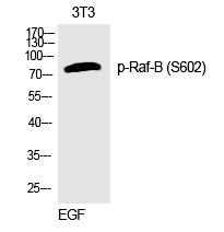 Rabbit Polyclonal Antibody to Raf-B (Phospho-Ser602)