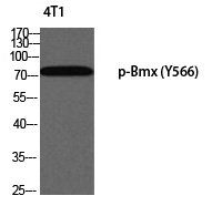 Rabbit Polyclonal Antibody to Bmx (Phospho-Tyr566)