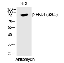 Rabbit Polyclonal Antibody to PKD1 (Phospho-Ser205)