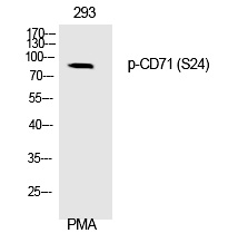 Rabbit Polyclonal Antibody to CD71 (Phospho-Ser24)