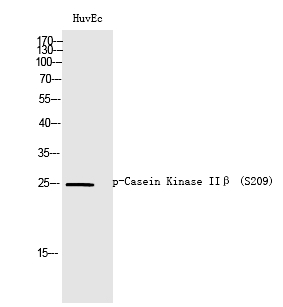Rabbit Polyclonal Antibody to Casein Kinase IIβ (Phospho-Ser209)