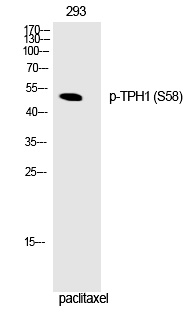 Rabbit Polyclonal Antibody to TPH1 (Phospho-Ser58)