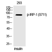 Rabbit Polyclonal Antibody to IRP-1 (Phospho-Ser711)