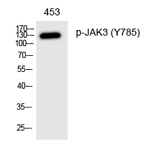 Rabbit Polyclonal Antibody to JAK3 (Phospho-Tyr785)