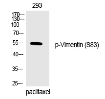 Rabbit Polyclonal Antibody to Vimentin (Phospho-Ser83)