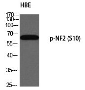 Rabbit Polyclonal Antibody to NF2 (Phospho-Ser10)
