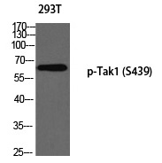Rabbit Polyclonal Antibody to Tak1 (Phospho-Ser439)