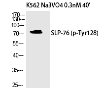 Rabbit Polyclonal Antibody to SLP-76 (Phospho-Tyr128)
