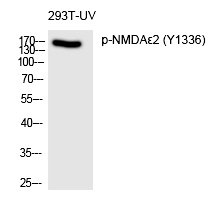 Rabbit Polyclonal Antibody to NMDAε2 (Phospho-Tyr1336)