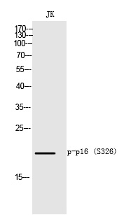 Rabbit Polyclonal Antibody to p16 (Phospho-Ser152)