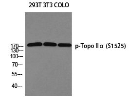 Rabbit Polyclonal Antibody to Topo IIα (Phospho-Ser1525)