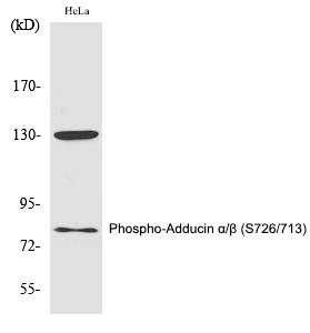 Rabbit Polyclonal Antibody to Adducin α/β (Phospho-Ser726/713)