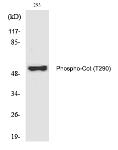 Rabbit Polyclonal Antibody to Cot (Phospho-Thr290)