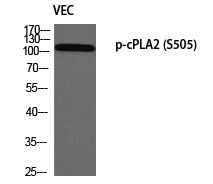 Rabbit Polyclonal Antibody to cPLA2 (Phospho-Ser505)