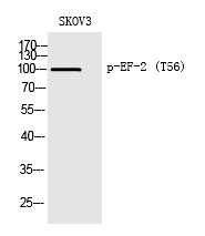 Rabbit Polyclonal Antibody to EF-2 (Phospho-Thr56)
