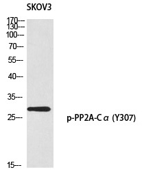 Rabbit Polyclonal Antibody to PP2A-Cα (Phospho-Tyr307)
